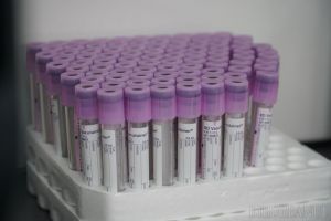 Asistenta din Bihor care a refuzat să dea probe biologice poliţiştilor a fost achitată. Ea e acuzată că a înlocuit sângele soţului prins beat la volan