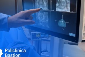 Biopsia de prostată cu fuziune RMN: diagnostic precis, fără risc de infecţie, în ambulator