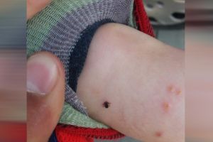 Mesajul revoltat al unui tată din Ploieşti, după ce copilul a fost muşcat de căpuşe