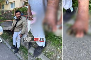 Apel nou pentru bărbatul din Satu Mare cu degerături grave: se strâng bani pentru asigurare medicală