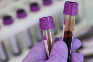 17 aprilie - Ziua Internaţională a Hemofiliei. Access la investigaţii, cu bilet de trimitere, la Clinica de Hematologie din Timişoara