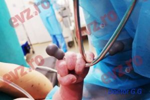 A prins stetoscopul medicului încă din prima secundă în care a venit pe lume!