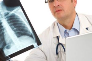 Incidenţa cazurilor de cancer bronhopulmonar, în creştere