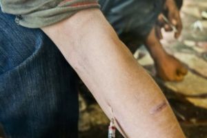 Povestea unui consumator de heroină injectabilă. „M-am întâlnit de două ori cu doamna cu coasa”