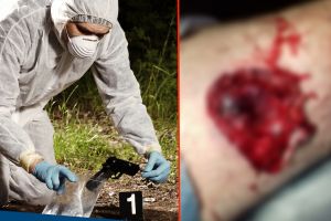 Diagnosticul medicilor în cazul bărbatului împuşcat la Sibiu