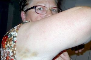 ȘOCANT. Femeie BĂTUTĂ pentru că NU şi-a lăsat tatăl să MOARĂ. Povestea ESTE HALUCINANTĂ 