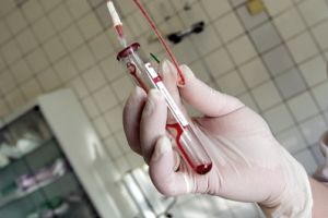 ANUNȚ UMANITAR: Un copil de 10 ani are nevoie, urgent, de sânge GRUPA 01 NEGATIV