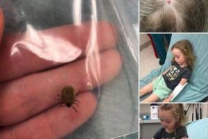 O fetiţă a fost muşcată de o căpuşă şi a apărut cel mai ciudat efect din câte îţi poţi imagina