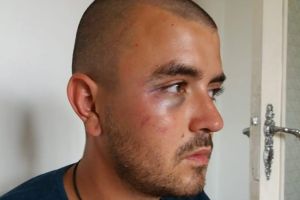 Un taximetrist acuza ca a fost batut si talharit, peste drum de Sectia 3 Politie Timisoara