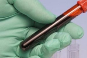 Firme care produc imunoglobulină investigate de Consiliul Concurenţei