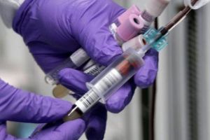 Cum îţi dai seama că ai ficatul bolnav. Cum să interpretezi corect analizele la ficat