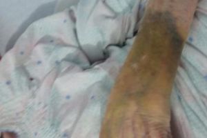 Acuzaţii grave la un azil de bătrâni: pacientă luată la palme de infirmieră