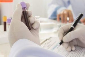 Eşti născut înainte de 1990? Mergi la doctor şi cere-i DE URGENŢĂ să îţi facă aceste analize!