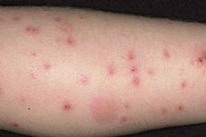 PURICI la un spital important. Li s-a spus tuturor: închideţi ochii  