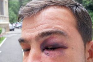 Un bărbat a  fost bătut pentru un motiv şocant! A întrebat cât costă o bicicletă aflată la vânzare!