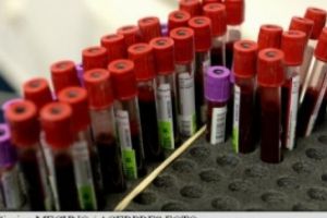 VEȘTI BUNE! O nouă analiză de sânge va putea identifica riscul de a suferi de cancer la plămâni