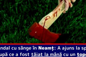 Scandal cu sânge în Neamţ: A ajuns la spital după ce a fost tăiat la mână cu un topor