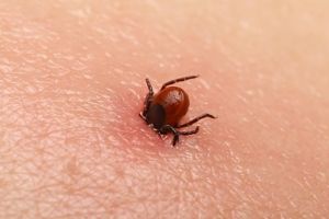 Primul ajutor în cazul înţepăturii de căpuşă