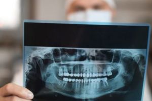 Un dentist suedez a fost CONCEDIAT şi AMENDAT după ce a DOVEDIT că 80% dintre migranţii COPII sunt ADULŢI. Ce i s-a întâmplat mai departe este strigător la cer 