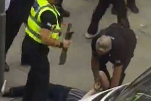 ȘOCANT! Un copil de 3 ani a fost ATACAT CU ACID