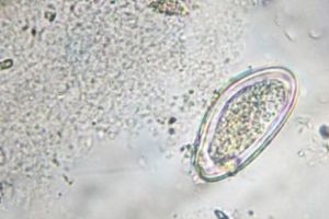 S-a trezit cu VIERMI ÎN CREIER de la fructele nespălate. Cazul care a CUTREMURAT lumea medicală