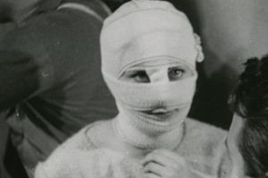 Înfiorător – Om găsit cu ochii scoşi la Tălmaciu. A mers cu ei în pungă la spital