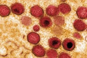 VIRUSUL care face RAVAGII în România!  Afost convocat Comitetul Naţional pentru combaterea bolilor