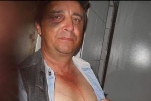 Bătut şi apoi tatuat cu cuţitul de bucătărie de către ginere. De la ce a început totul