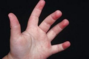 Caz socant. Nou-nascut prematur, incinerat  fara necropsie. Procurorii fac verificari 