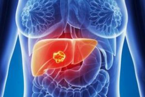 Simptome care indică probleme la ficat. Care sunt primele semne