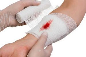 Cum acţionăm în caz de hemoragie