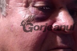 Localnic din Bustuchin, agresat de vecin pentru nişte găini! Lovită  cu pumnii şi picioarele, victima însângerată a ajuns pe patul de spital