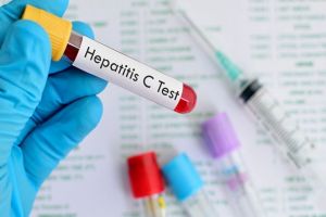 Prescripţii pentru tratarea gratuită a hepatitei cu medicaţie interferon-free