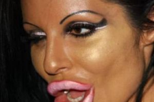 VESTE NEAGRĂ pentru femeile cu BOTOX. Dacă ştiau ce păţesc, NU ar mai fi făcut OPERAȚIA