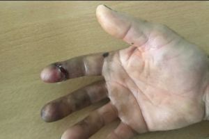 Ultraj la Penitenciarul Arad. Un deţinut înarmat cu un ciob l-a tăiat pe un supraveghetor