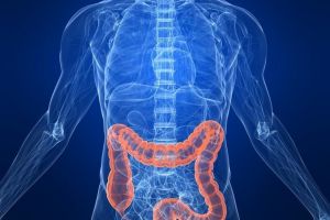 Cancerul colorectal, vindecabil dacă se depistează la timp