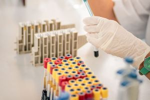 Încă o ruşine: Oficialii Laboratorului român Antidoping muşamalizau testele pozitive. Directorul şi adjunctul său, maziliţi