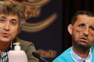 Dr. Omer Ozkan, primul chirurg din lume care a realizat un transplant de uter şi printre primii care au transplantat faţă şi membre: „Oamenii care au rămas fără mâini şi picioare le-ar putea avea din nou”