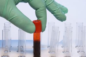 Imunoglobulina subcutanată, disponibilă în premieră în România