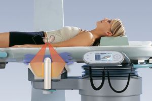 Cum scapi de calculii renali fără ajutorul bisturiului