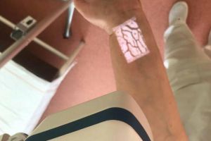 Spitalul Novaci s-a dotat cu un dispozitiv inteligent de vizualizare a venelor