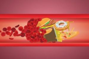 10 cauze ale colesterolului crescut