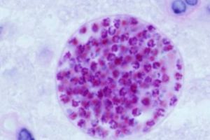 Parazitul care NE CONTROLEAZĂ MINTEA. Jumătate din populaţia umană a intrat în contact cu el