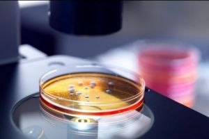 Alertă mondială! Bacteriile UCIGAŞE care REZISTĂ la ANTIBIOTICE devin tot mai PUTERNICE şi aproape IMPOSIBIL de tratat. Câţi oameni vor muri în următoarii ani