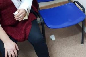 Cluj: Medicii de la UPU Cluj au fixat cu carton mâna ruptă a unei femei lovite de o maşină - FOTO
