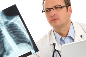 A crescut numărul bolnavilor de cancer pulmonar