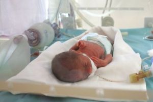 Bebeluşul de 990 g REFUZAT de maternităţi, salvat la Timişoara. Medicii spun că e ”stabil” acum