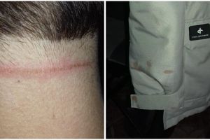 Una dintre femeile batute in statia de tramvai: M-a lovit cu pumnii in cap, dadea ca animalul