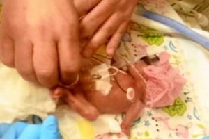 Ziua mondială a prematurităţii