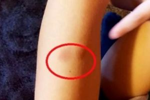 Băiat din Lugoj înţepat şi muşcat la grădiniţă